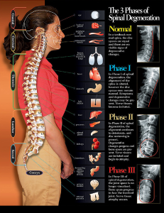 Showing the 3 phases of spinal degeneration as well as the organs these nerves connect to
