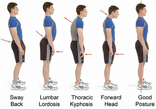 Bad Posture: How It Hurts and Our Top 4 fixes